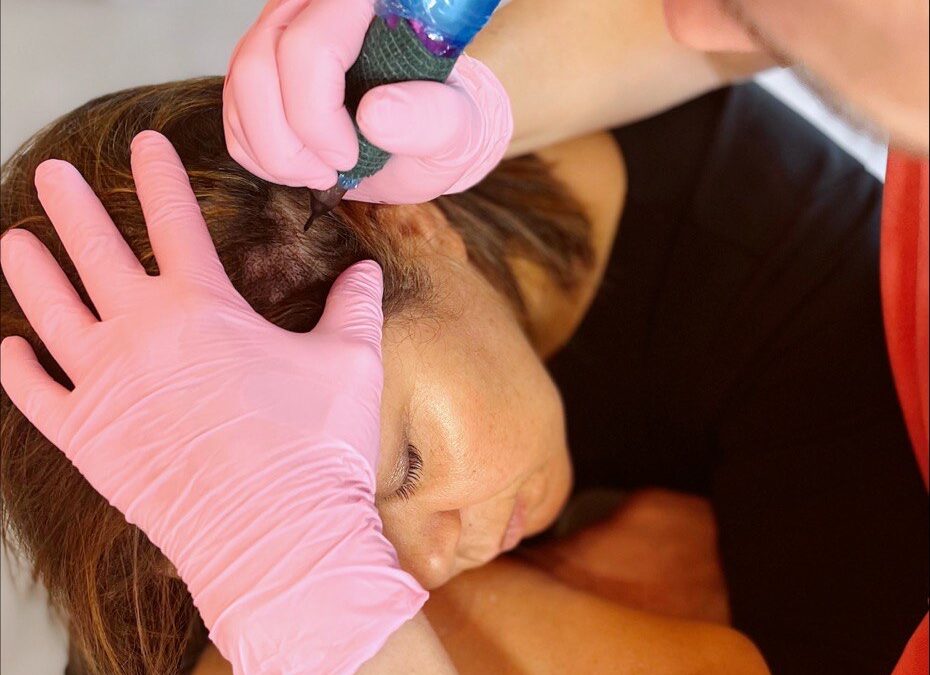 Scalp micropigmentation for women Austin, Texas